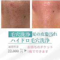 画像390
