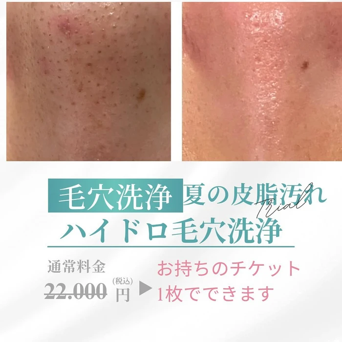 画像390
